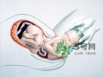 順產(chǎn)和剖腹產(chǎn)哪個(gè)好？順產(chǎn)和剖腹產(chǎn)哪個(gè)痛？