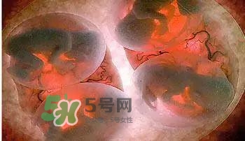 多胞胎順產(chǎn)怎么生？多胞胎剖腹產(chǎn)和單胎剖腹產(chǎn)的區(qū)別