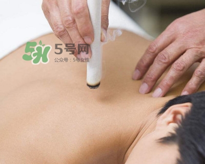 艾灸器具哪種好？艾灸后皮膚極癢為什么