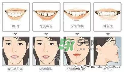 乳牙齲齒要不要補(bǔ)？乳牙齲齒怎么辦？