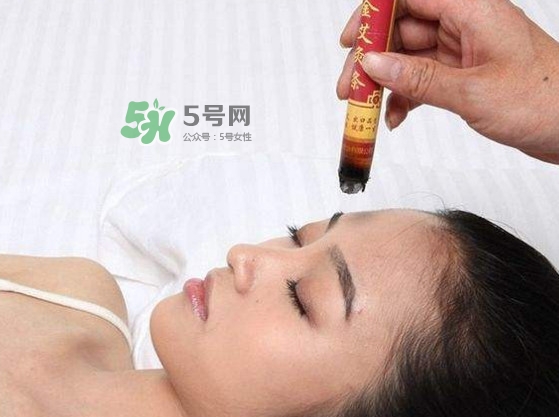 艾灸會(huì)不會(huì)過(guò)敏？艾灸過(guò)敏怎么辦