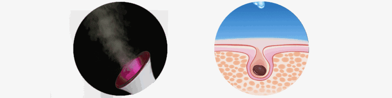 蒸臉器的最佳使用方法 蒸臉器哪個牌子好 蒸臉器的最佳使用方法 蒸臉器哪個牌子好