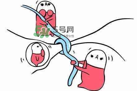 結(jié)扎好還是上環(huán)好？結(jié)扎上環(huán)哪個(gè)危害小？