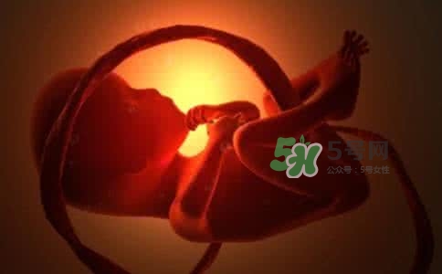 寶寶臍帶繞頸只能剖腹產(chǎn)嗎？胎兒臍帶繞頸孕婦有什么感覺