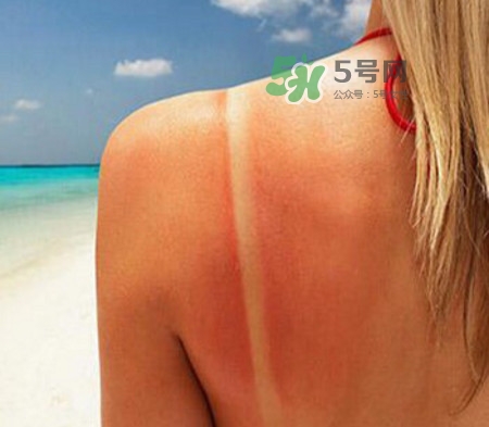 曬后如何修復 曬后修復成分有哪些 曬后如何修復 曬后修復成分有哪些