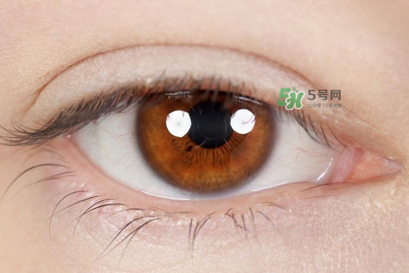 做近視手術(shù)多少錢？做近視手術(shù)的條件