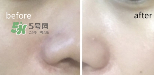 hr綠寶瓶新肌水怎么用？赫蓮娜綠寶瓶新肌水使用方法