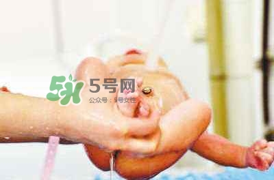 羊水栓塞是醫(yī)療事故嗎？羊水栓塞多發(fā)生于順產(chǎn)還是剖腹產(chǎn)？