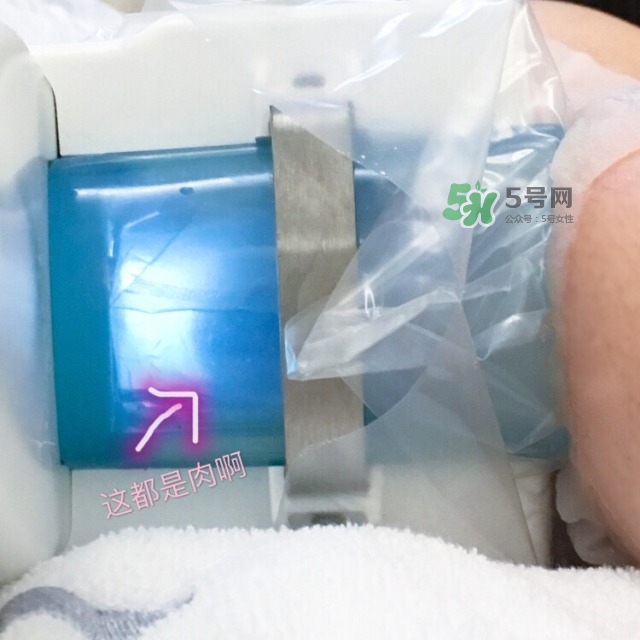 酷塑溶脂效果對(duì)比圖片 酷塑溶脂全過程記錄 酷塑溶脂效果對(duì)比圖片 酷塑溶脂全過程記錄