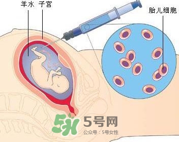 羊水栓塞是怎么回事？羊水栓塞怎么預(yù)防？