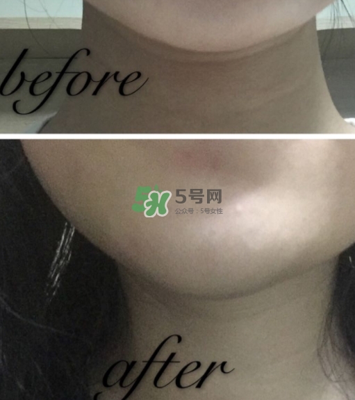 olay小白瓶有哪些版本？olay小白瓶版本區(qū)別