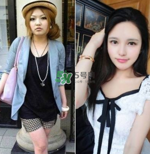 周揚(yáng)青在哪里整容的？周揚(yáng)青整容整了哪里？