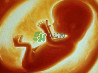 臍帶繞頸是什么原因造成的？臍帶繞頸是多休息還是多運動？