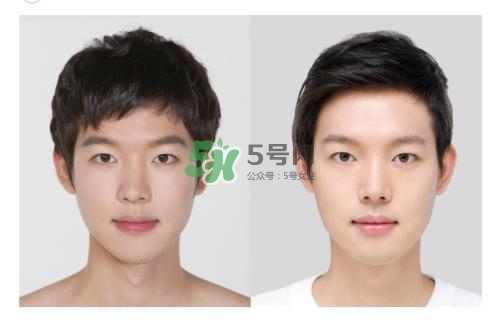 美白針有副作用嗎？美白針有什么副作用？