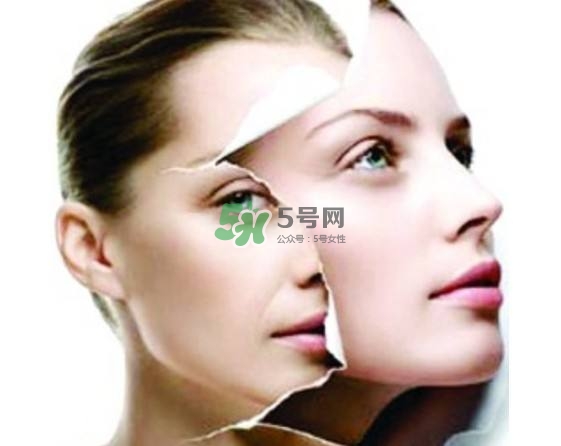 美白針有副作用嗎？美白針有什么副作用？