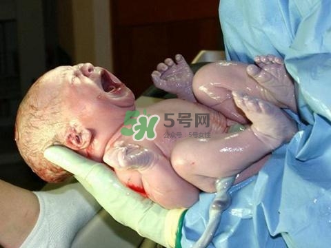 順產(chǎn)有多疼？順產(chǎn)的疼痛可以忍受嗎？