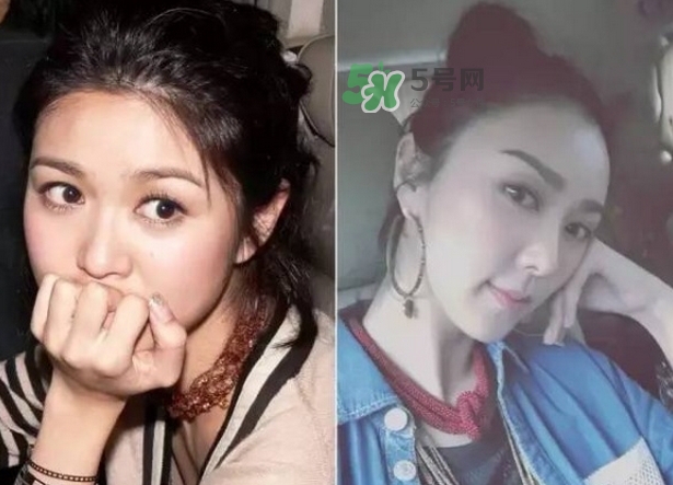 發(fā)際線低怎么調整？標準的發(fā)際線圖片