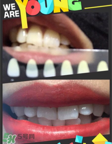 碧緹福美牙儀有副作用嗎？碧緹福美牙儀副作用是什么？