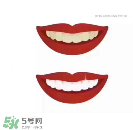 美牙儀能帶上飛機(jī)嗎？美牙儀可以過安檢嗎？