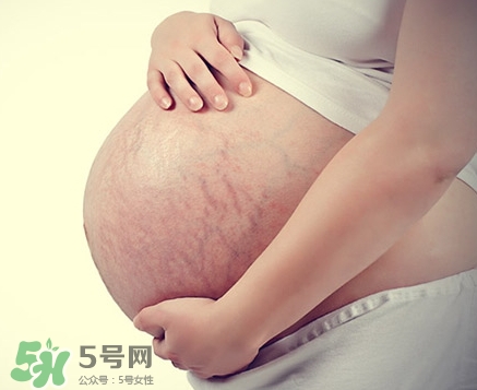 孕婦胸部長(zhǎng)妊娠紋嗎？胸部長(zhǎng)妊娠紋了怎么辦？