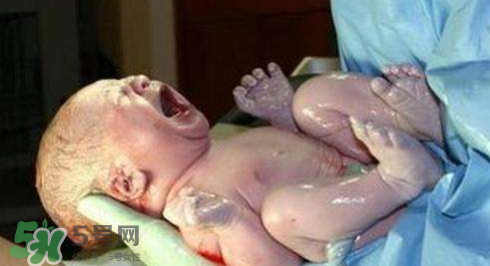 剪臍帶時(shí)寶寶會(huì)不會(huì)疼？剪臍帶寶寶疼嗎？