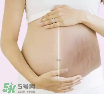 長妊娠紋的前兆 長妊娠紋很癢怎么辦？