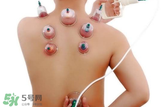 火罐和真空罐哪個(gè)好？真空罐和火罐效果一樣好嗎