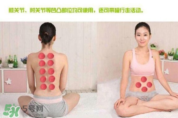 火罐和真空罐哪個(gè)好？真空罐和火罐效果一樣好嗎