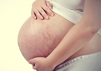 孕婦胸部長(zhǎng)妊娠紋嗎？胸部長(zhǎng)妊娠紋了怎么辦？