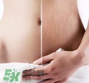 妊娠紋什么時(shí)候變白？妊娠紋產(chǎn)品什么時(shí)候用？