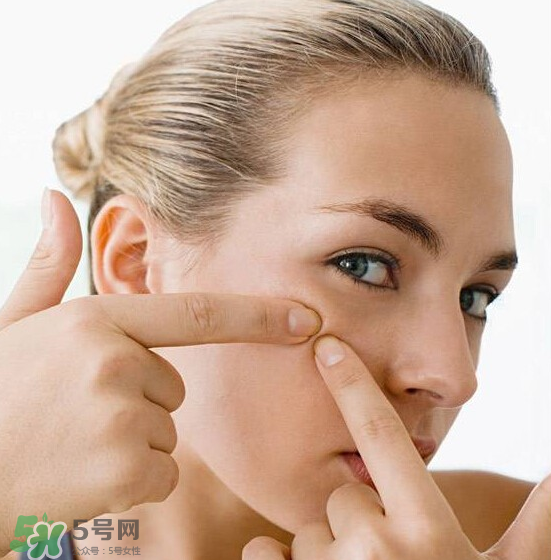 長痘長閉口怎么辦？長痘長閉口是什么原因？