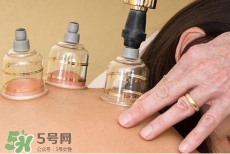 真空拔罐有用嗎？真空拔罐多長時間合適