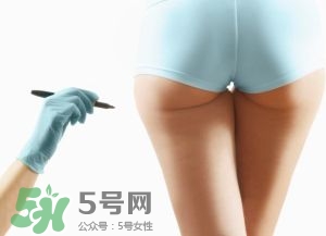 吸脂減肥副作用有哪些？吸脂減肥可靠嗎？