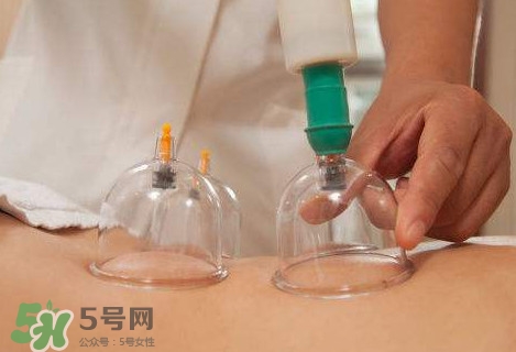 真空拔罐有用嗎？真空拔罐多長時間合適