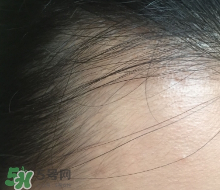 發(fā)際線粉要卸妝嗎_怎么卸？