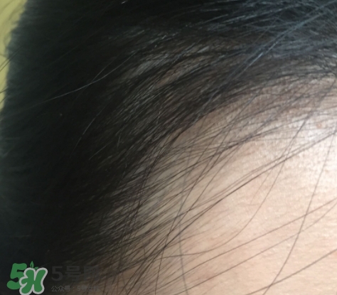 發(fā)際線粉要卸妝嗎_怎么卸？