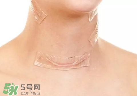 硅膠疤痕貼有用嗎？硅膠疤痕貼效果怎么樣？