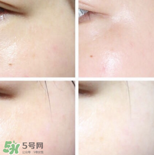 城野醫(yī)生377孕婦可以用嗎？城野醫(yī)生377孕婦用好嗎？