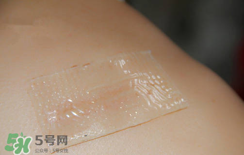 仙卡疤痕貼有用嗎？仙卡疤痕貼效果怎么樣？