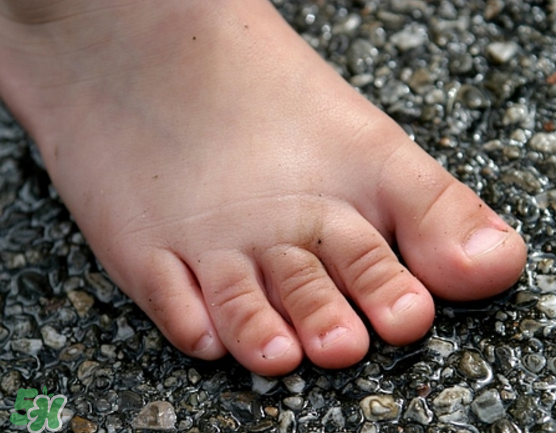 日本灰指甲藥水有用嗎？日本灰指甲藥水評(píng)測(cè)