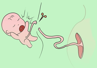 寶寶臍帶什么時候脫落？寶寶臍帶脫落后怎么護理？