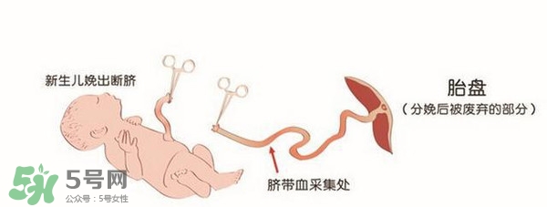 臍帶血有必要保存嗎？臍帶血有什么用？