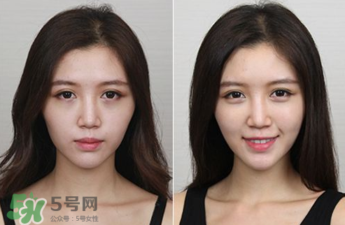 蘋果肌怎么化？蘋果肌究竟哪里好？