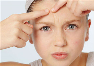 暗瘡可以擠壓嗎？油性和骯臟肌膚會容易有暗瘡嗎？