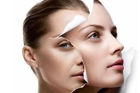 天生的魚尾紋怎么去除或淡化 天生的魚尾紋怎么去除或淡化