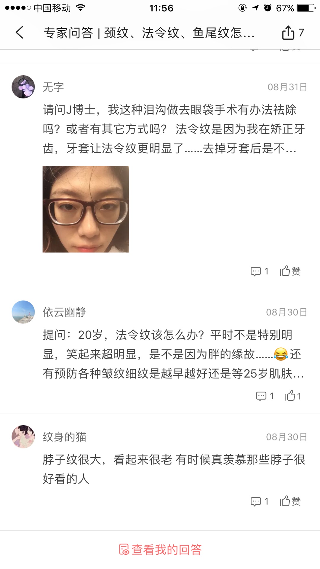 天生的魚尾紋怎么去除或淡化 天生的魚尾紋怎么去除或淡化