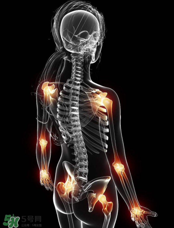 風(fēng)濕要忌口嗎？風(fēng)濕飲食禁忌