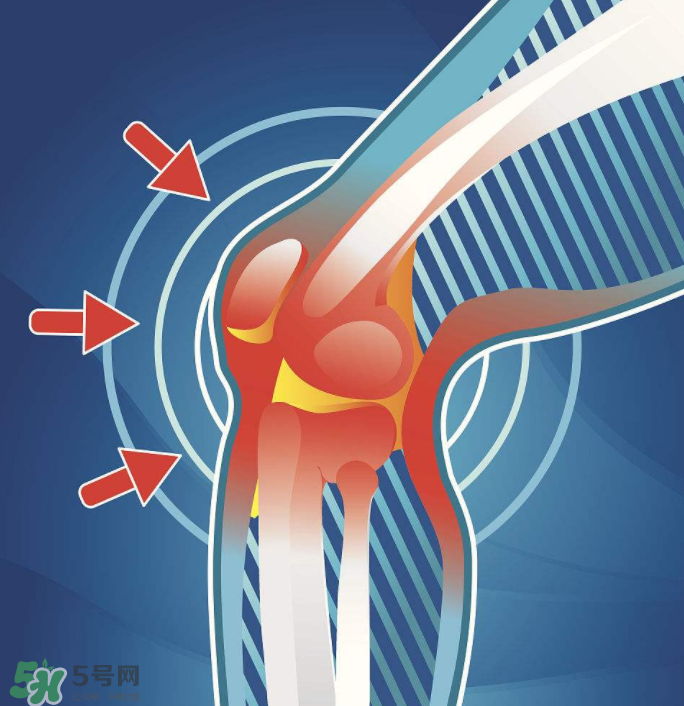 風(fēng)濕要忌口嗎？風(fēng)濕飲食禁忌