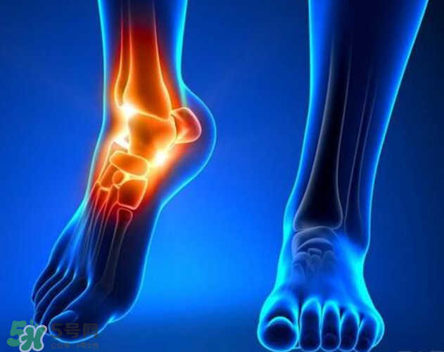 風(fēng)濕要忌口嗎？風(fēng)濕飲食禁忌