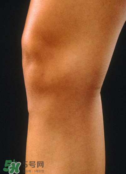 風(fēng)濕要做哪些檢查？風(fēng)濕要檢查哪些項目？